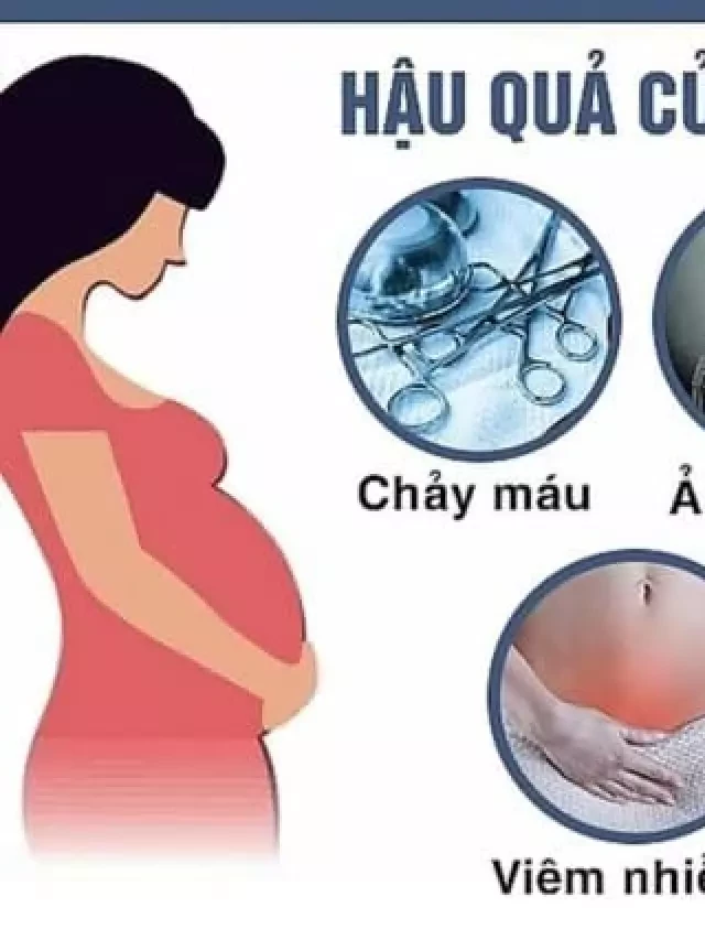   5 Nghiệp Phá Thai, Sau Khi Phá Thai Nên Làm Gì Tâm Linh?